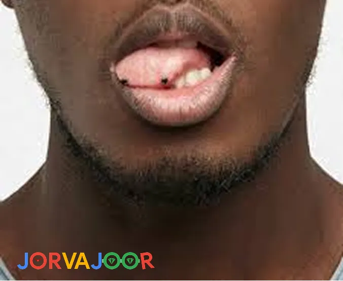 اسنیک آیز تیره