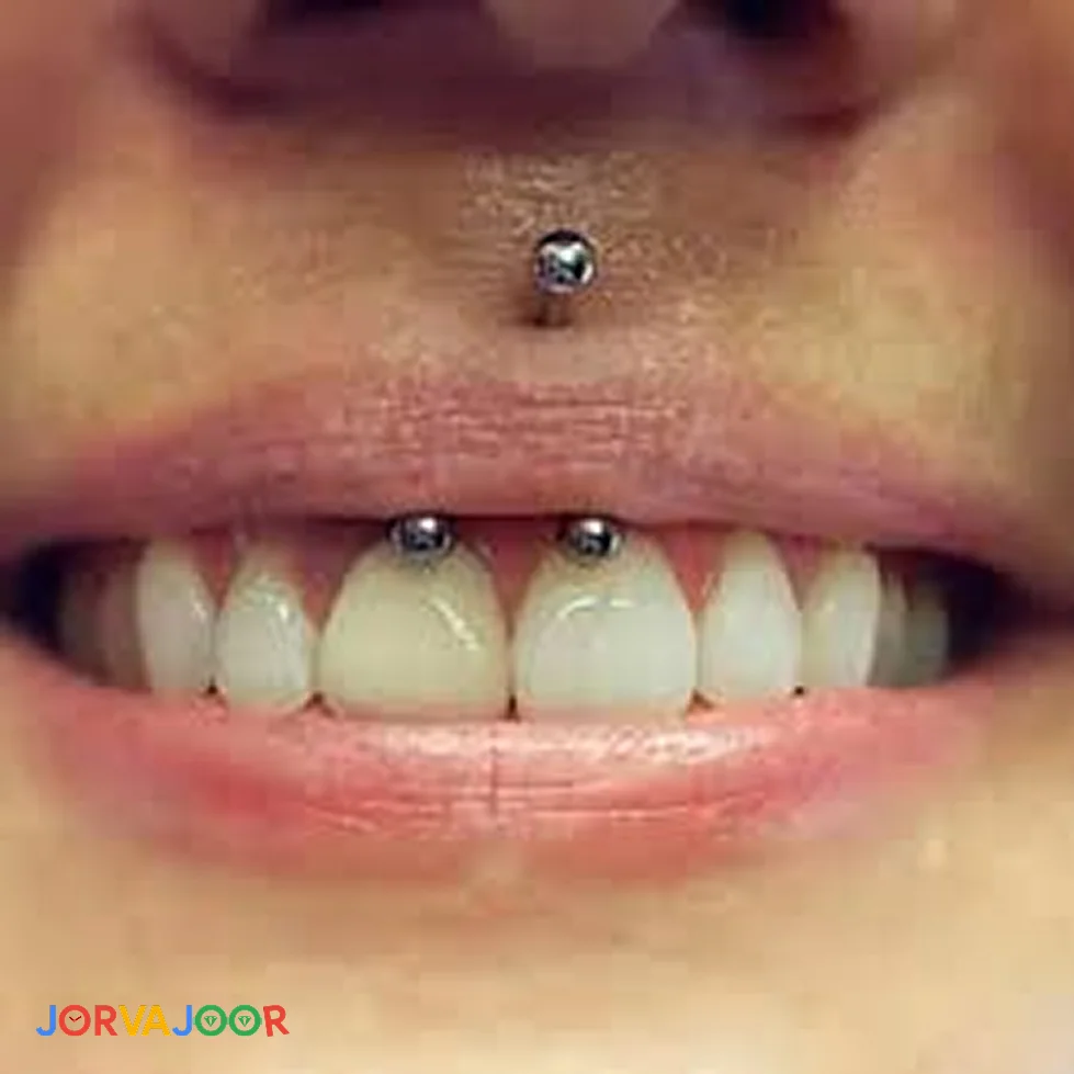 پیرسینگ اسمایل