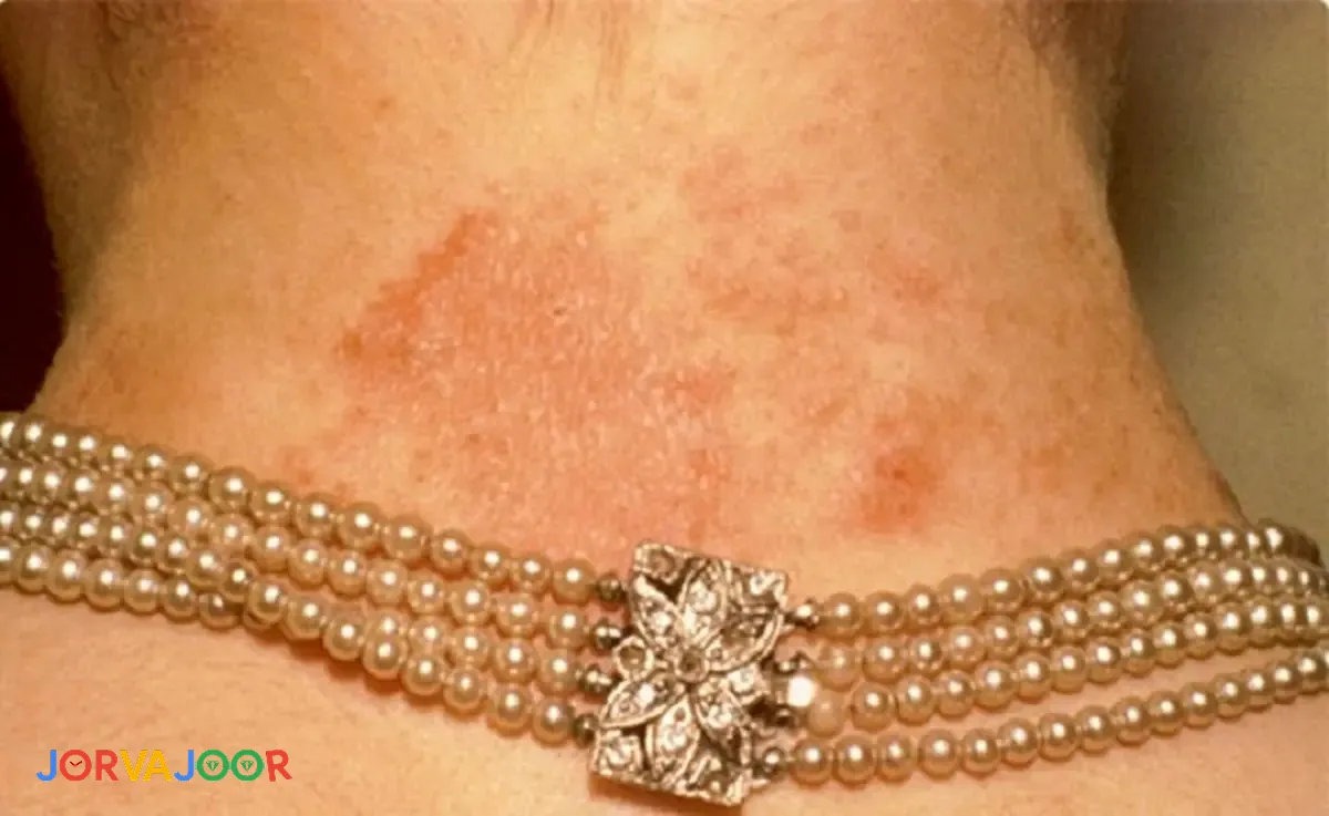 بدلیجات استیل