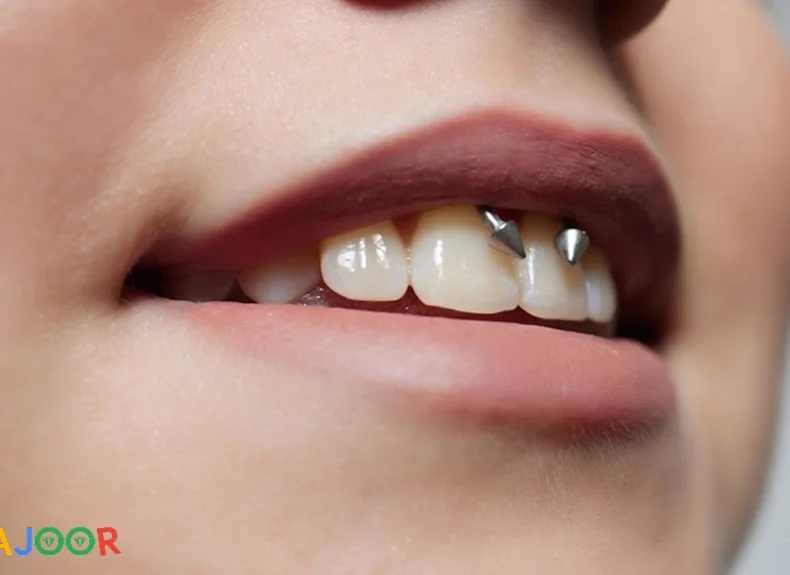 پیرسینگ اسمایل